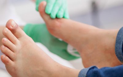 Cómo prevenir el pie diabético: el papel clave de la podología