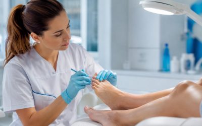 Hongos en las Uñas de los Pies (Onicomicosis): Causas, Tratamiento y Prevención