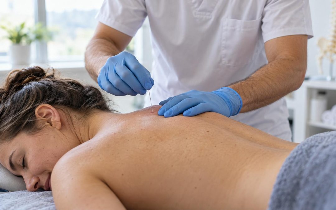 Fisioterapeuta aplicando punción seca en el trapecio de un paciente